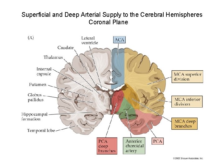 Superficial and Deep Arterial Supply to the Cerebral Hemispheres Coronal Plane 