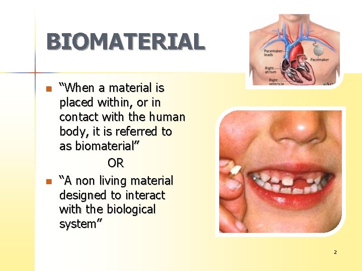 BIOMATERIAL n n “When a material is placed within, or in contact with the