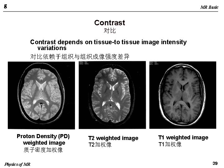 g MR Basic Contrast 对比 Contrast depends on tissue-to tissue image intensity variations 对比依赖于组织与组织成像强度差异