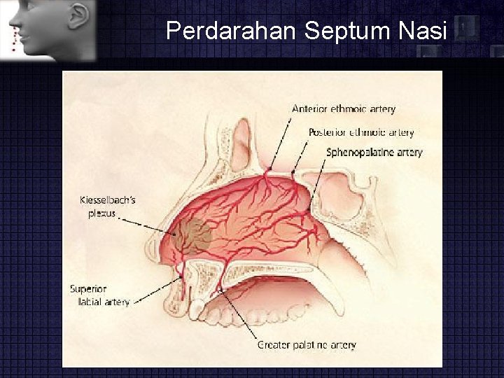 Perdarahan Septum Nasi 