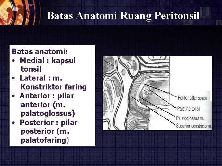 Batas Anatomi Ruang Peritonsil Batas anatomi: • Medial : kapsul tonsil • Lateral :