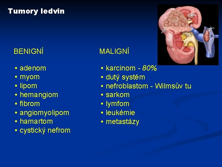 Tumory ledvin BENIGNÍ MALIGNÍ • adenom • myom • lipom • hemangiom • fibrom