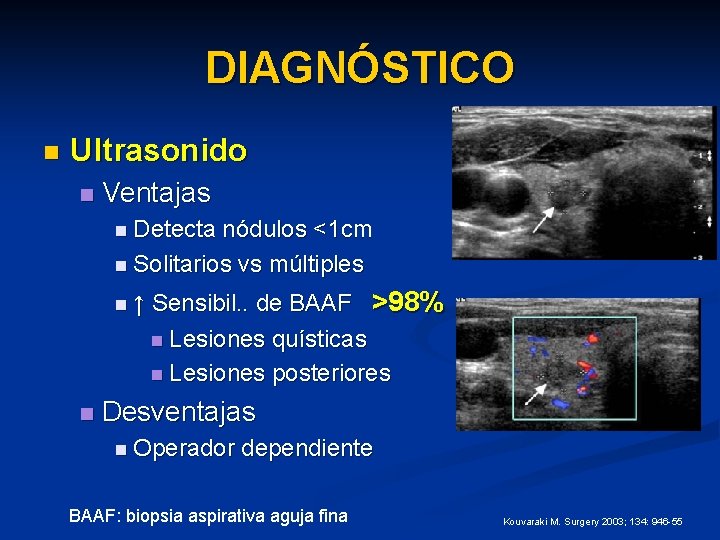 DIAGNÓSTICO n Ultrasonido n Ventajas n Detecta nódulos <1 cm n Solitarios vs múltiples