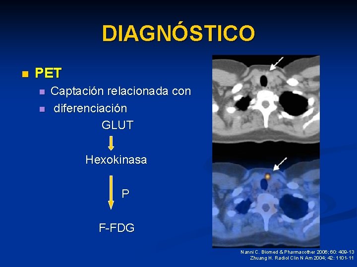 DIAGNÓSTICO n PET n n Captación relacionada con diferenciación GLUT Hexokinasa P F-FDG Nanni