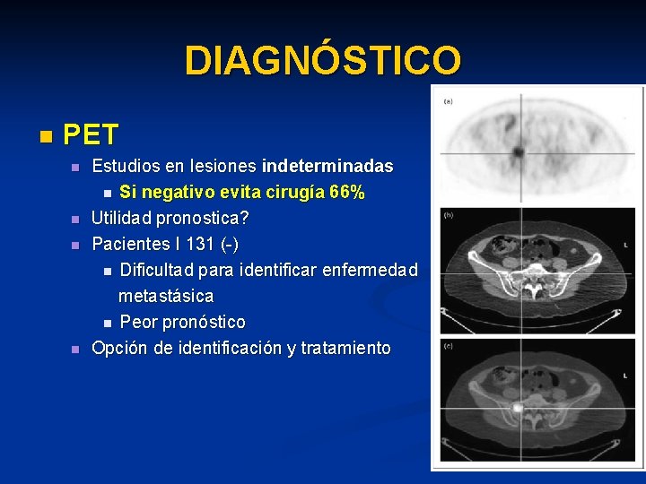 DIAGNÓSTICO n PET n n Estudios en lesiones indeterminadas n Si negativo evita cirugía