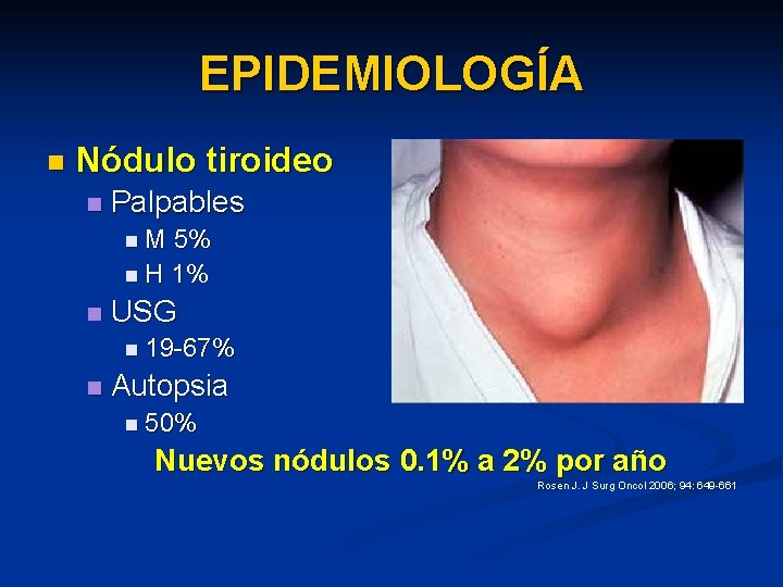 EPIDEMIOLOGÍA n Nódulo tiroideo n Palpables n. M 5% n H 1% n USG