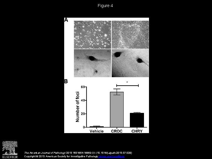 Figure 4 The American Journal of Pathology 2013 1831654 -1666 DOI: (10. 1016/j. ajpath.