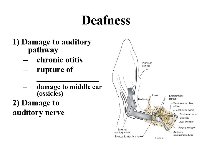 Deafness 1) Damage to auditory pathway – chronic otitis – rupture of ________ –