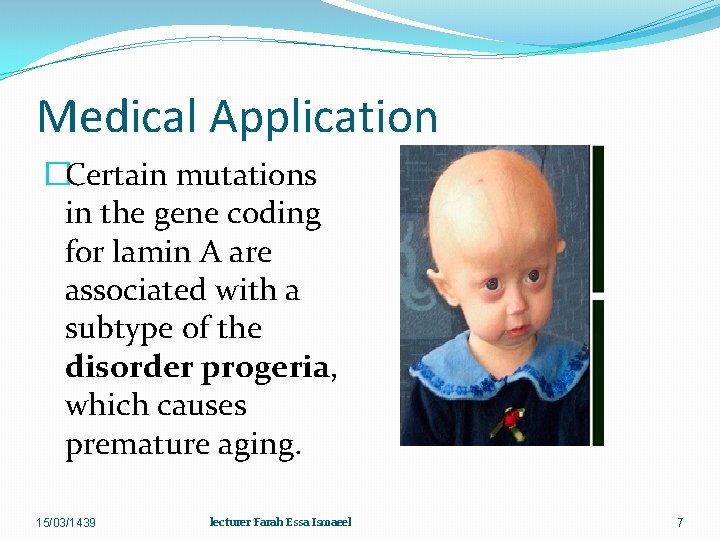 Medical Application �Certain mutations in the gene coding for lamin A are associated with