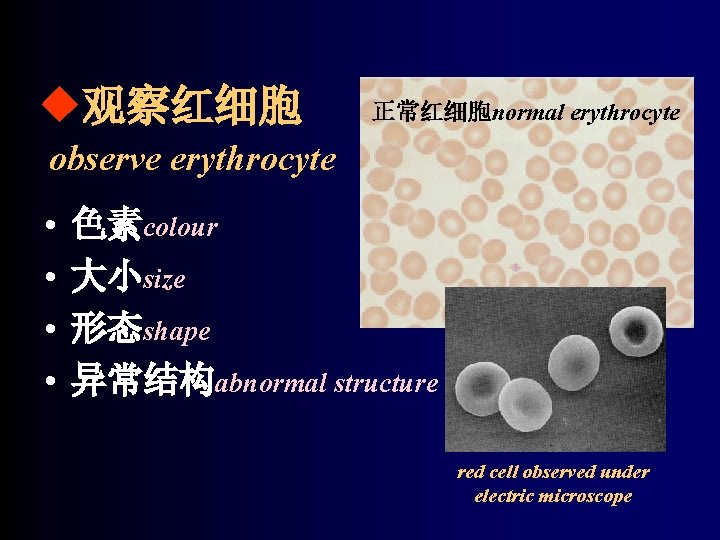 u观察红细胞 正常红细胞normal erythrocyte observe erythrocyte • • 色素colour 大小size 形态shape 异常结构abnormal structure red cell