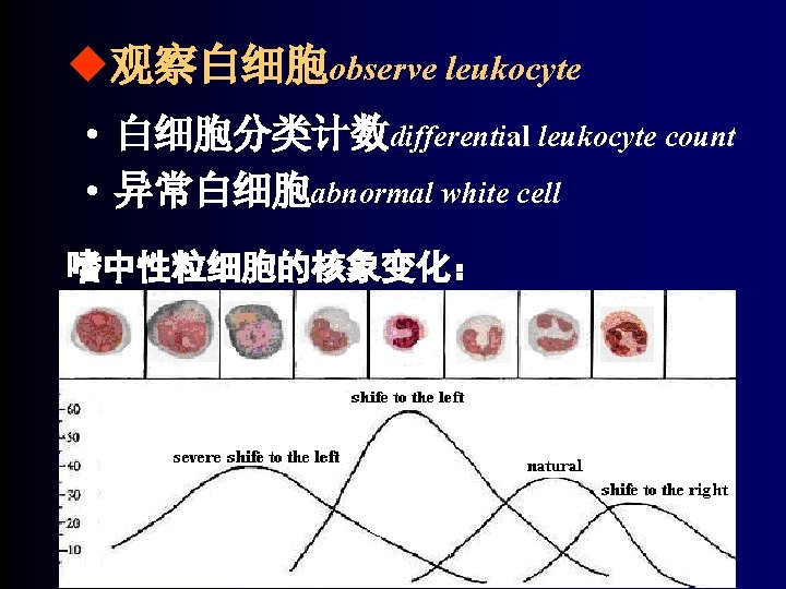 u观察白细胞observe leukocyte • 白细胞分类计数differential leukocyte count • 异常白细胞abnormal white cell 嗜中性粒细胞的核象变化： 