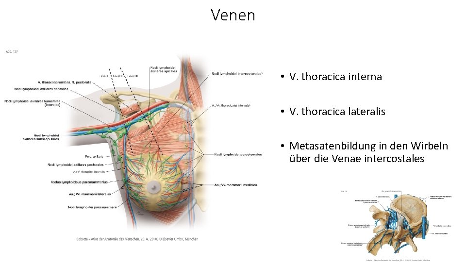 Venen • V. thoracica interna • V. thoracica lateralis • Metasatenbildung in den Wirbeln