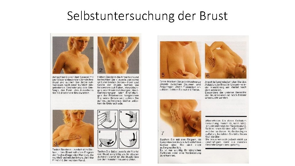 Selbstuntersuchung der Brust 