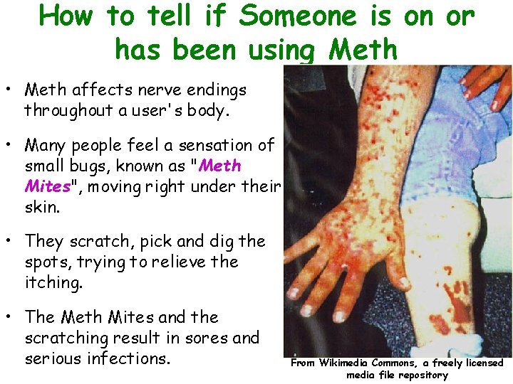 How to tell if Someone is on or has been using Meth • Meth
