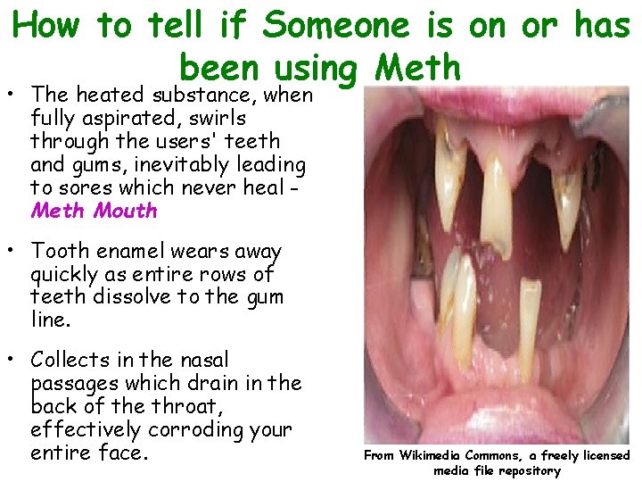 How to tell if Someone is on or has been using Meth • The