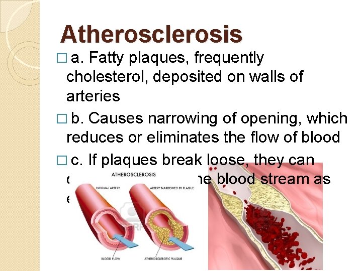 Atherosclerosis � a. Fatty plaques, frequently cholesterol, deposited on walls of arteries � b.