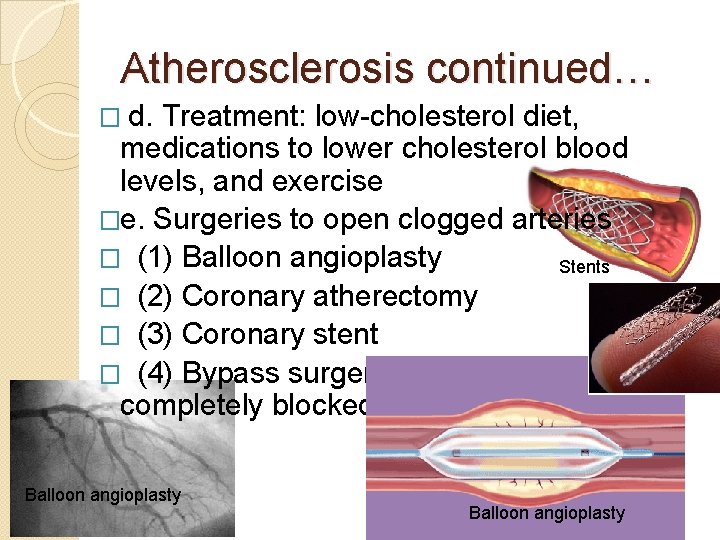 Atherosclerosis continued… � d. Treatment: low-cholesterol diet, medications to lower cholesterol blood levels, and