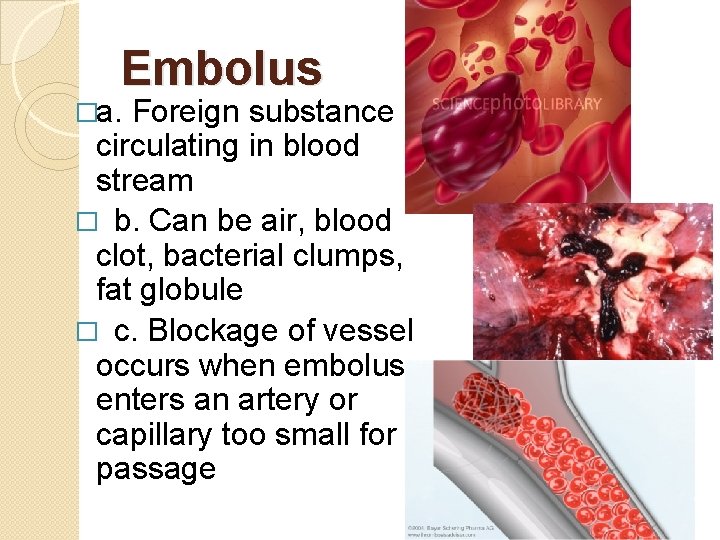 Embolus �a. Foreign substance circulating in blood stream � b. Can be air, blood