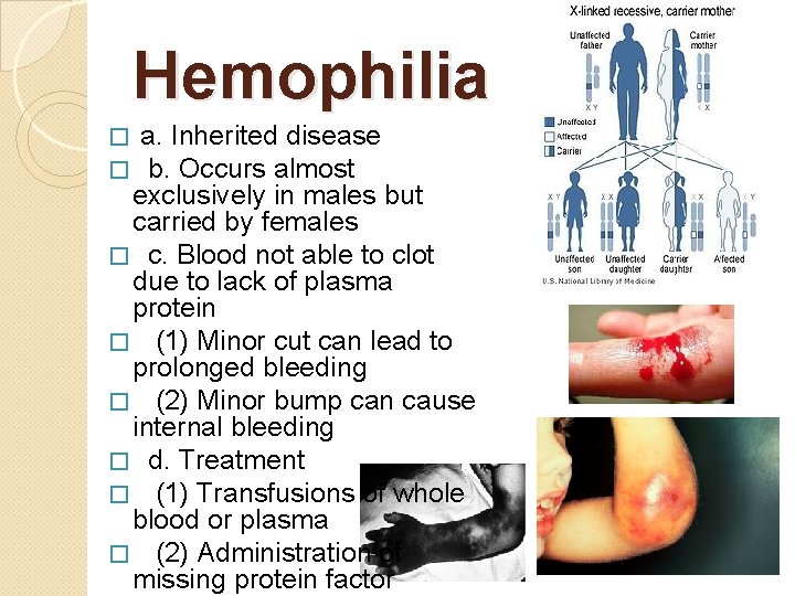 Hemophilia a. Inherited disease b. Occurs almost exclusively in males but carried by females