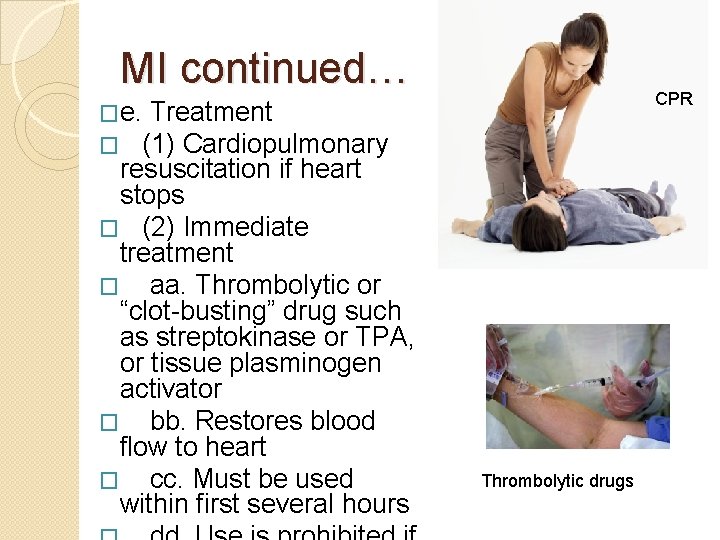 MI continued… CPR �e. Treatment � (1) Cardiopulmonary resuscitation if heart stops � (2)