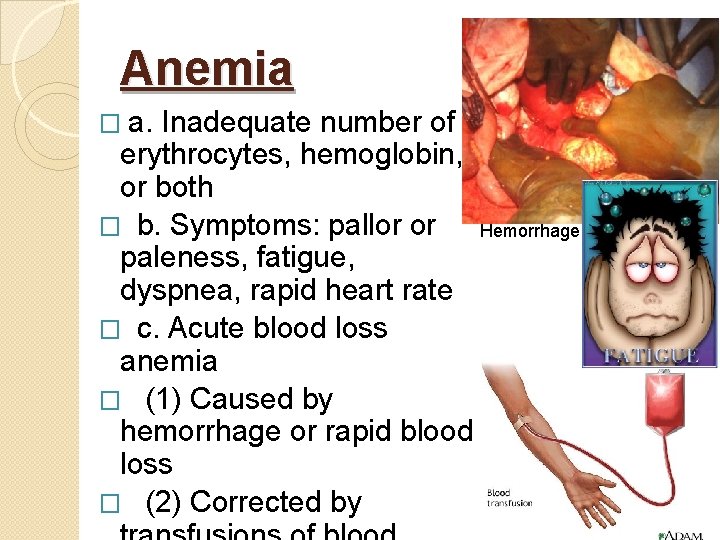 Anemia � a. Inadequate number of erythrocytes, hemoglobin, or both � b. Symptoms: pallor