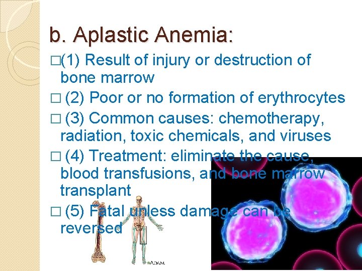 b. Aplastic Anemia: �(1) Result of injury or destruction of bone marrow � (2)