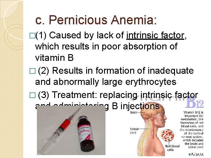 c. Pernicious Anemia: �(1) Caused by lack of intrinsic factor, which results in poor