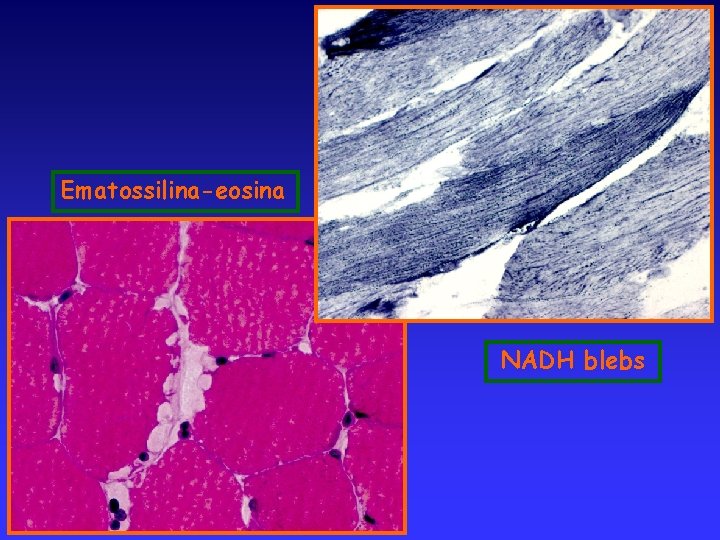 Ematossilina-eosina NADH blebs 