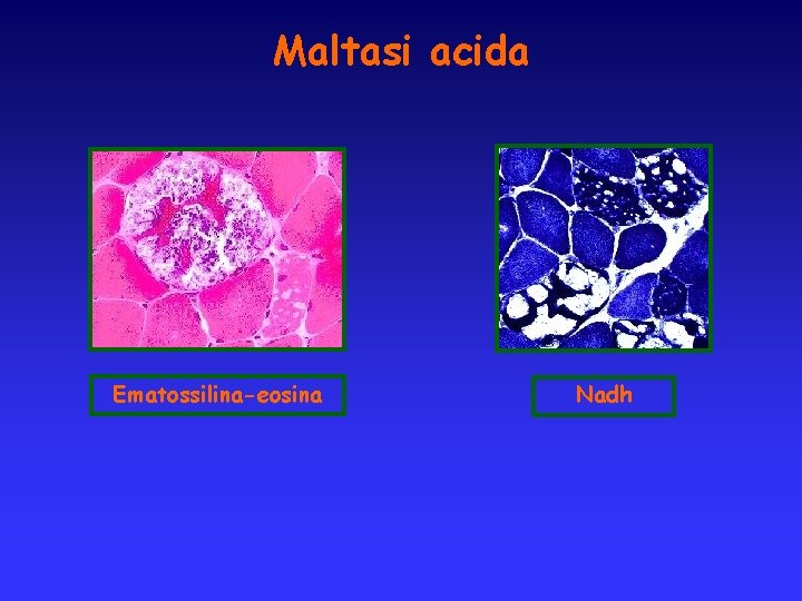 Maltasi acida Ematossilina-eosina Nadh 