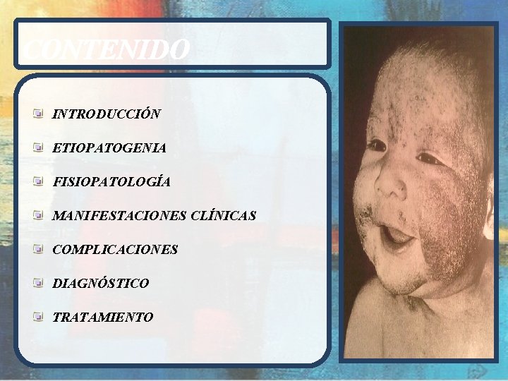 CONTENIDO INTRODUCCIÓN ETIOPATOGENIA FISIOPATOLOGÍA MANIFESTACIONES CLÍNICAS COMPLICACIONES DIAGNÓSTICO TRATAMIENTO 