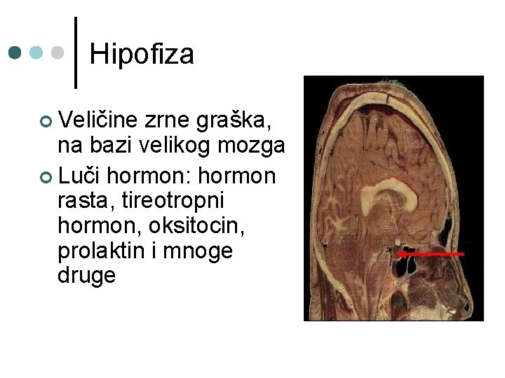 Hipofiza ¢ Veličine zrne graška, na bazi velikog mozga ¢ Luči hormon: hormon rasta,