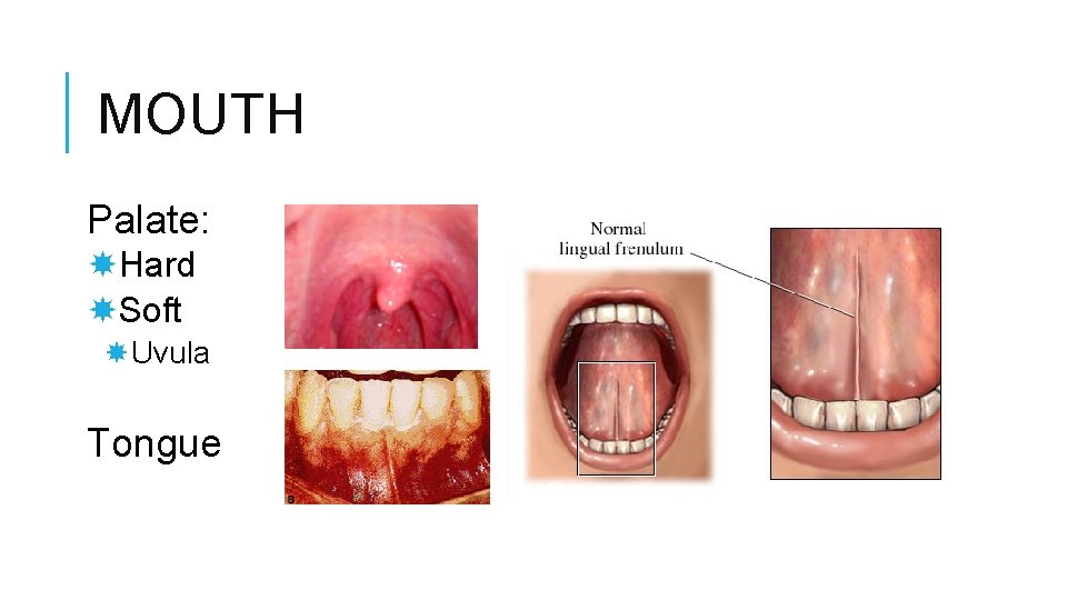 MOUTH Palate: Hard Soft Uvula Tongue 