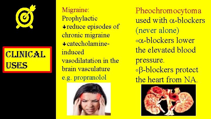 clinical uses Migraine: Prophylactic reduce episodes of chronic migraine catecholamineinduced vasodilatation in the brain