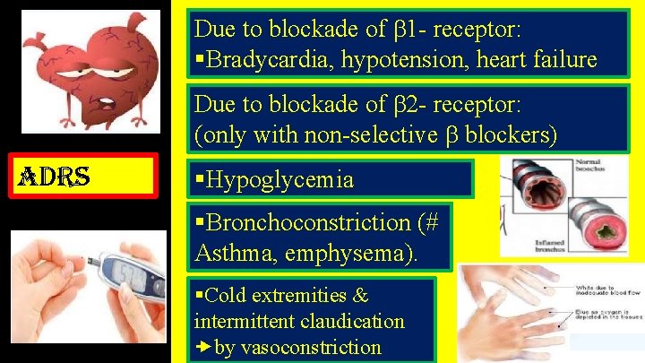 Due to blockade of 1 - receptor: §Bradycardia, hypotension, heart failure Due to blockade