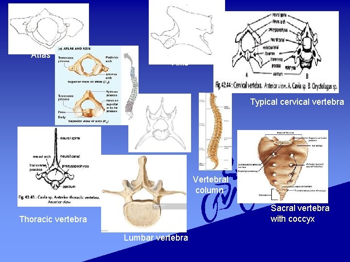 Atlas Axis Typical cervical vertebra Vertebral column Sacral vertebra with coccyx Thoracic vertebra Lumbar