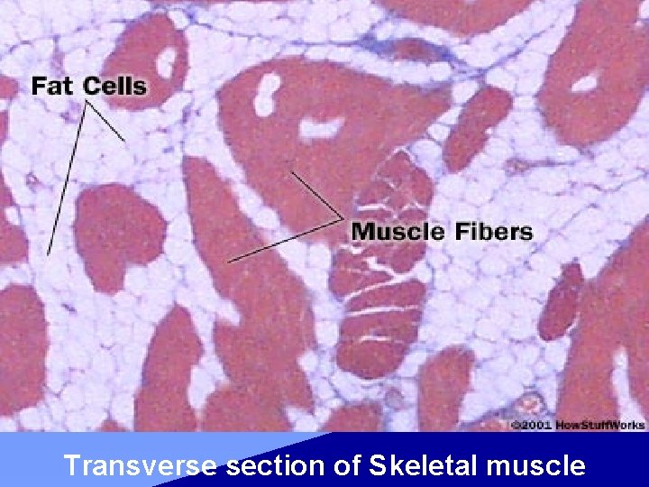 Transverse section of Skeletal muscle 