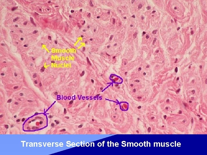 Transverse Section of the Smooth muscle 