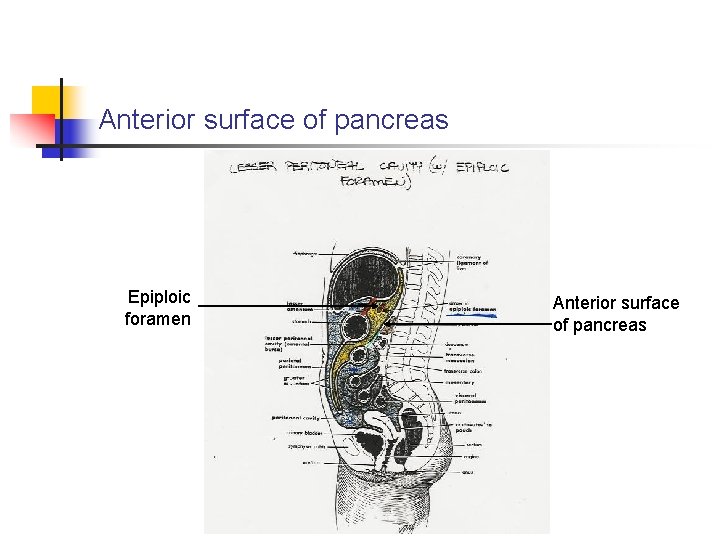 Anterior surface of pancreas Epiploic foramen Anterior surface of pancreas 
