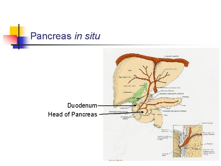 Pancreas in situ Duodenum Head of Pancreas 