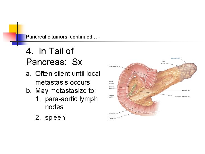 Pancreatic tumors, continued … 4. In Tail of Pancreas: Sx a. Often silent until