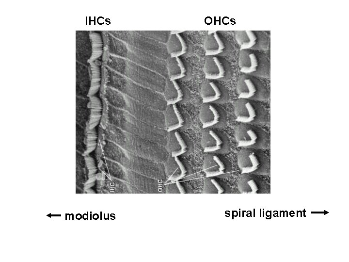 IHCs modiolus OHCs spiral ligament 