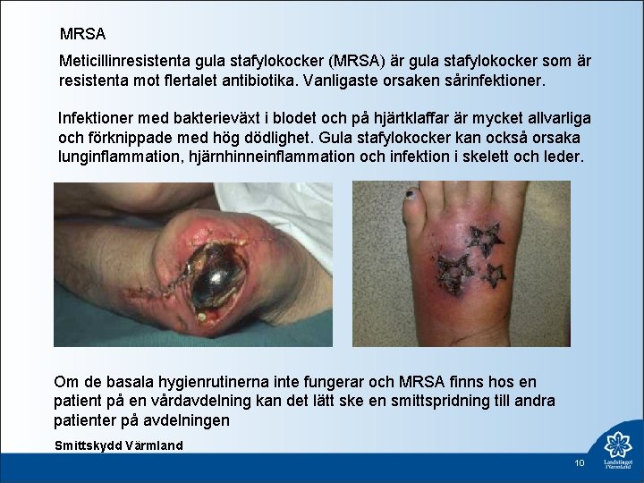 MRSA Meticillinresistenta gula stafylokocker (MRSA) är gula stafylokocker som är resistenta mot flertalet antibiotika.