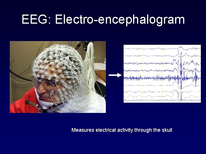 EEG: Electro-encephalogram Measures electrical activity through the skull 