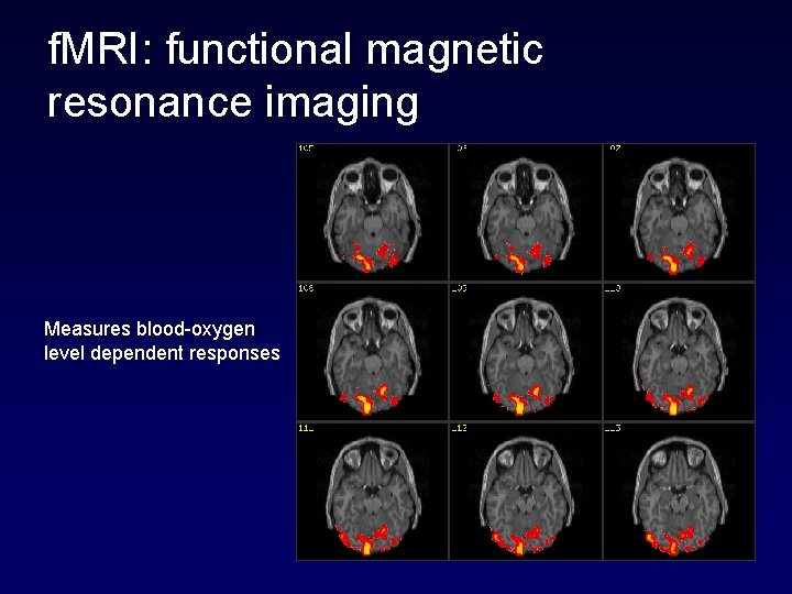 f. MRI: functional magnetic resonance imaging Measures blood-oxygen level dependent responses 