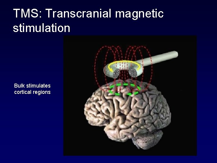 TMS: Transcranial magnetic stimulation Bulk stimulates cortical regions 