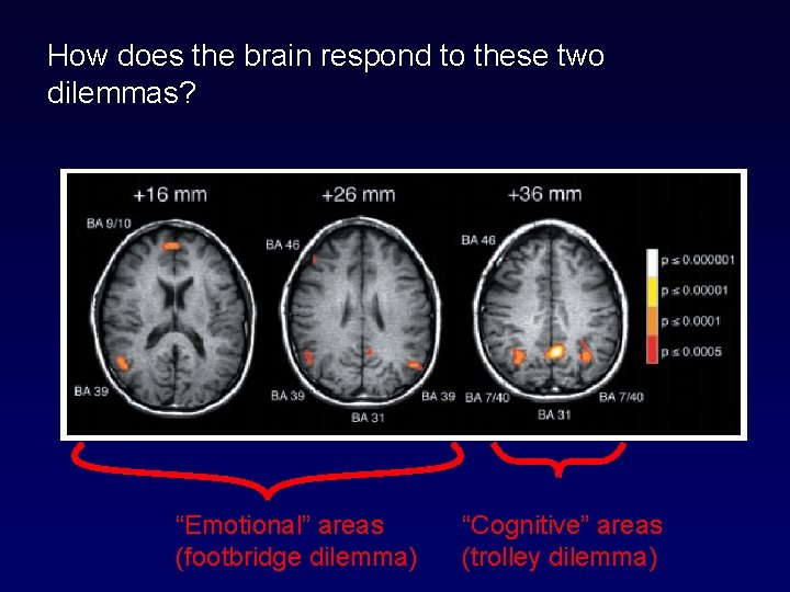 How does the brain respond to these two dilemmas? “Emotional” areas (footbridge dilemma) “Cognitive”