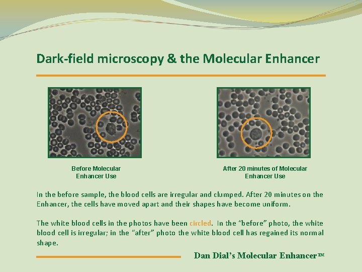 Dark-field microscopy & the Molecular Enhancer Before Molecular Enhancer Use After 20 minutes of