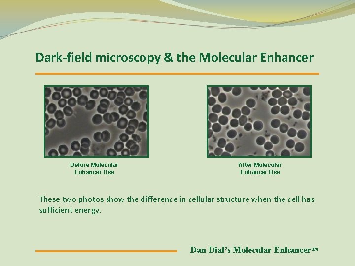 Dark-field microscopy & the Molecular Enhancer Before Molecular Enhancer Use After Molecular Enhancer Use