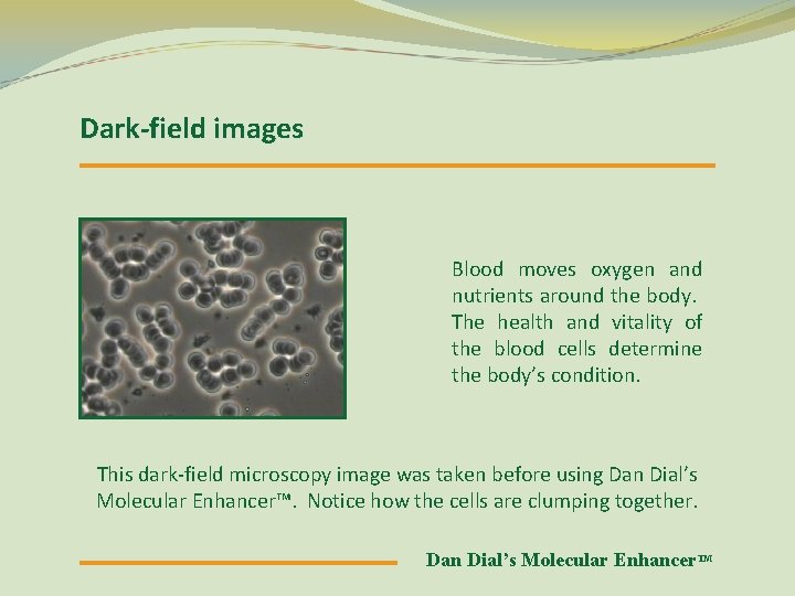 Dark-field images Blood moves oxygen and nutrients around the body. The health and vitality