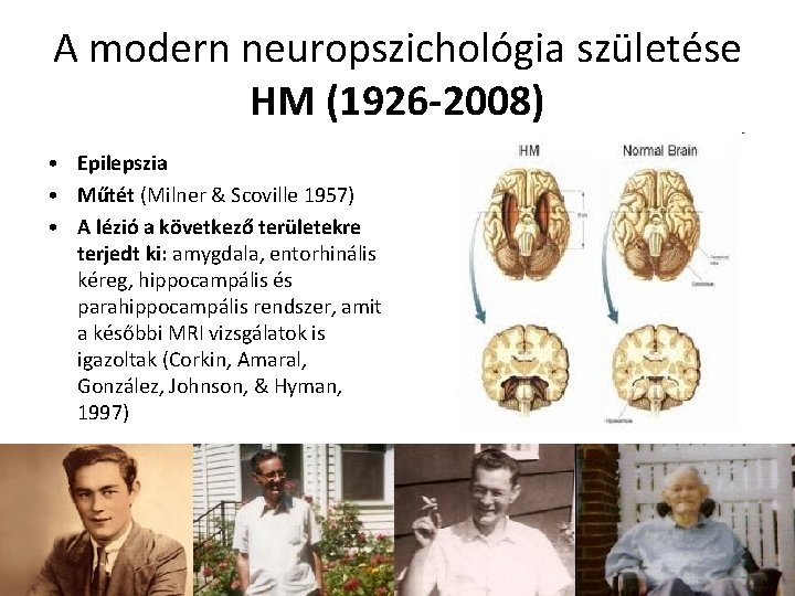 A modern neuropszichológia születése HM (1926 -2008) • Epilepszia • Műtét (Milner & Scoville